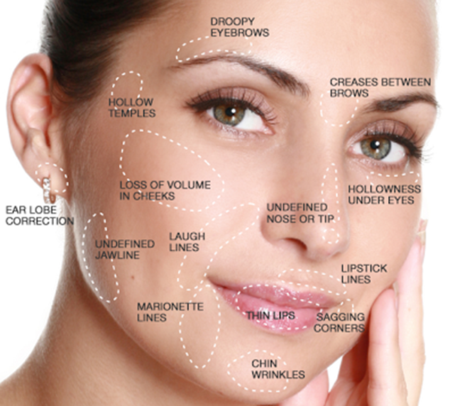 Sept15_Ask Ellen_Dermal Fillers