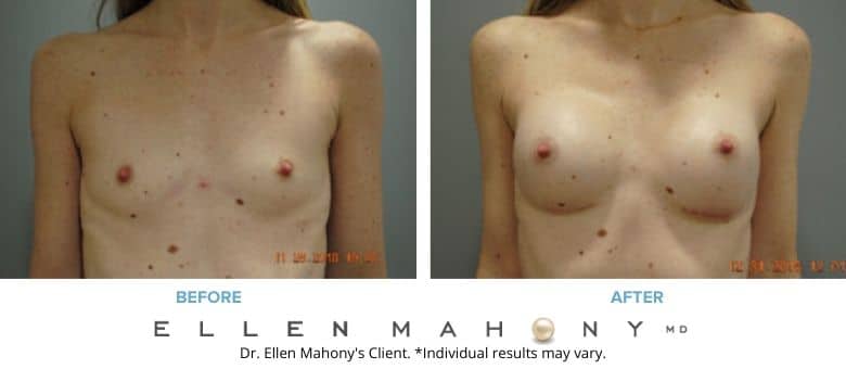 Case #8765 - Ellen A. Mahony, MD