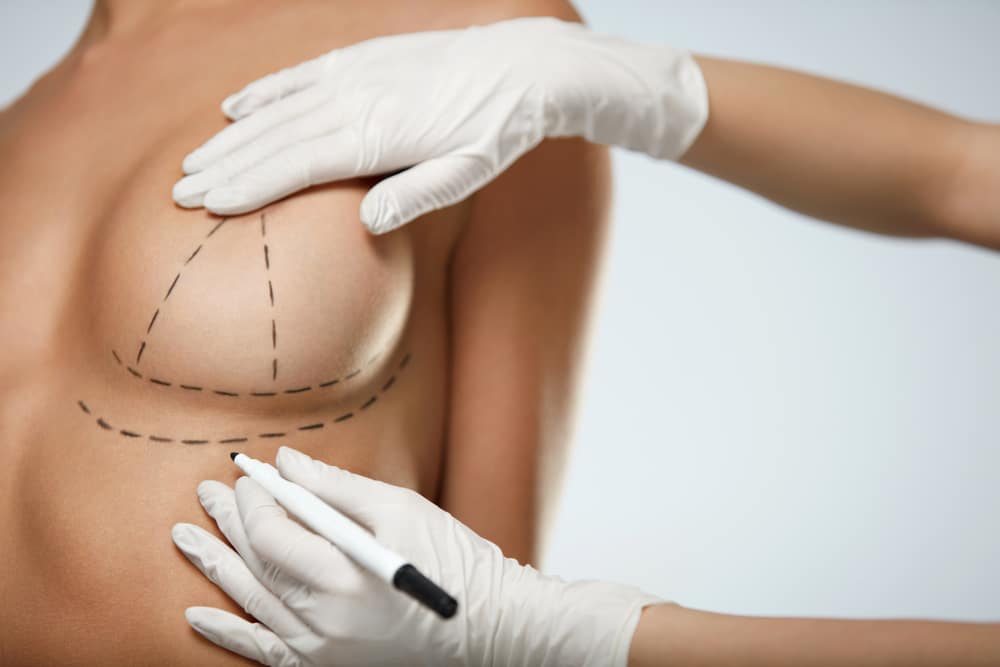 Breast Lift or Breast Reduction: The Differences