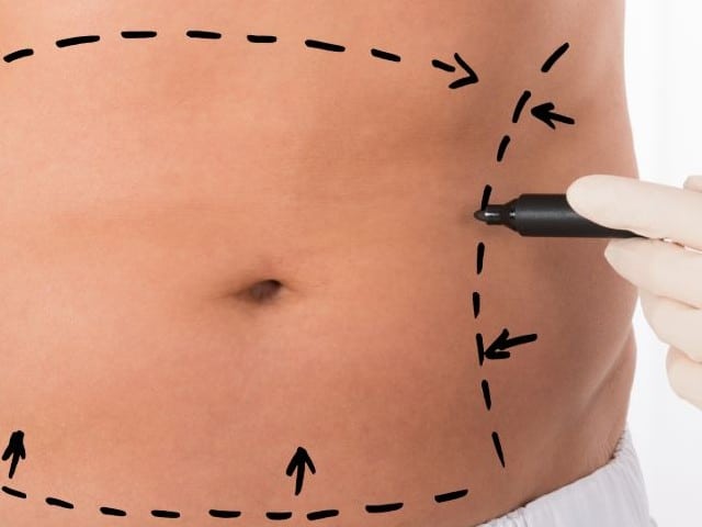 Close-up Of Person Hands Drawing Correction Lines On Stomach