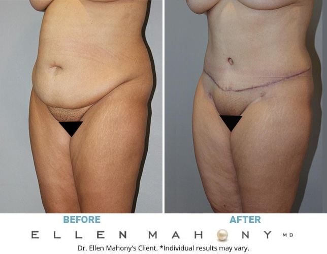 Before and After Image: Case #12856 - left-front-oblique