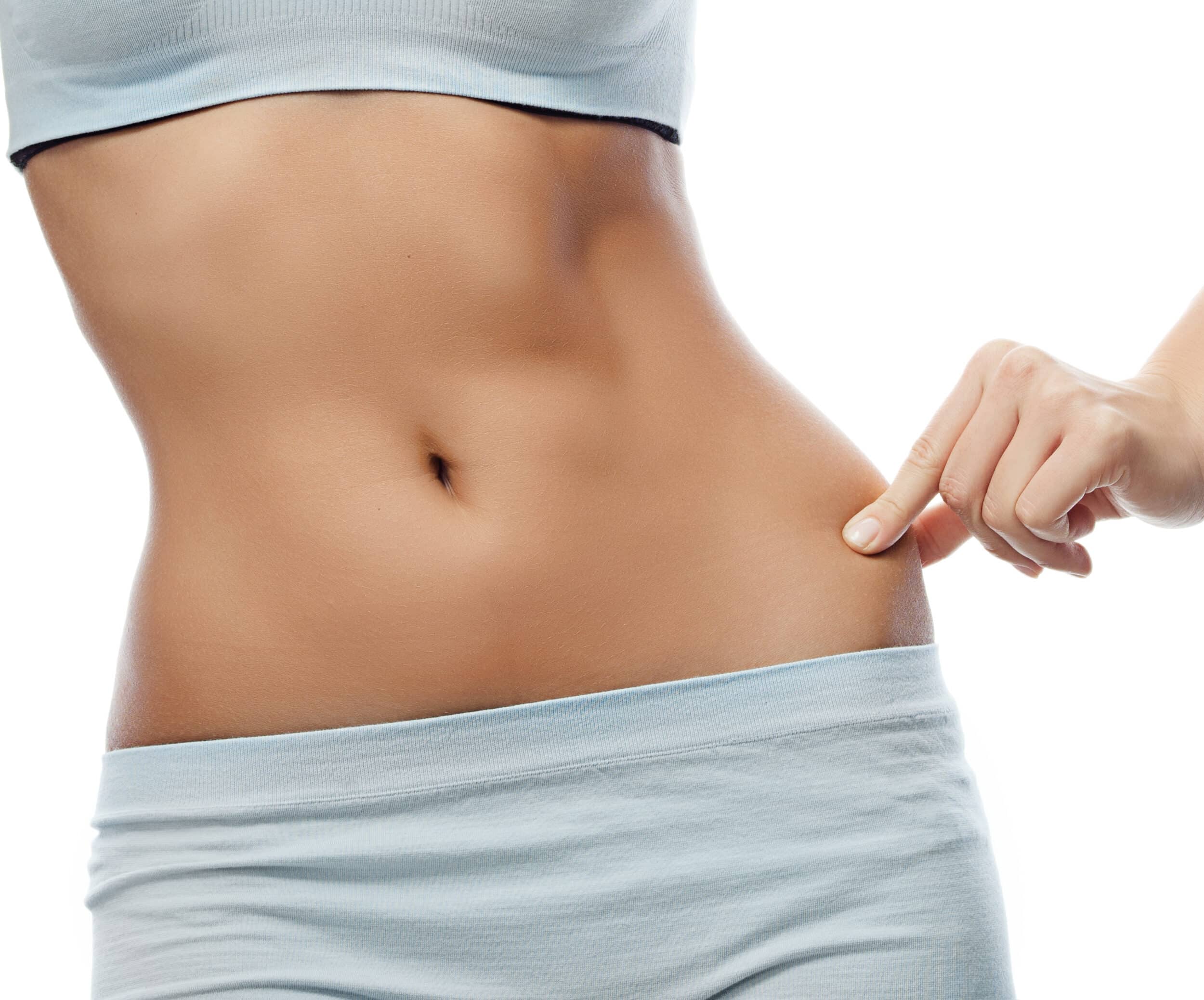 Woman holding loose skin around her tummy area after significant weight loss
