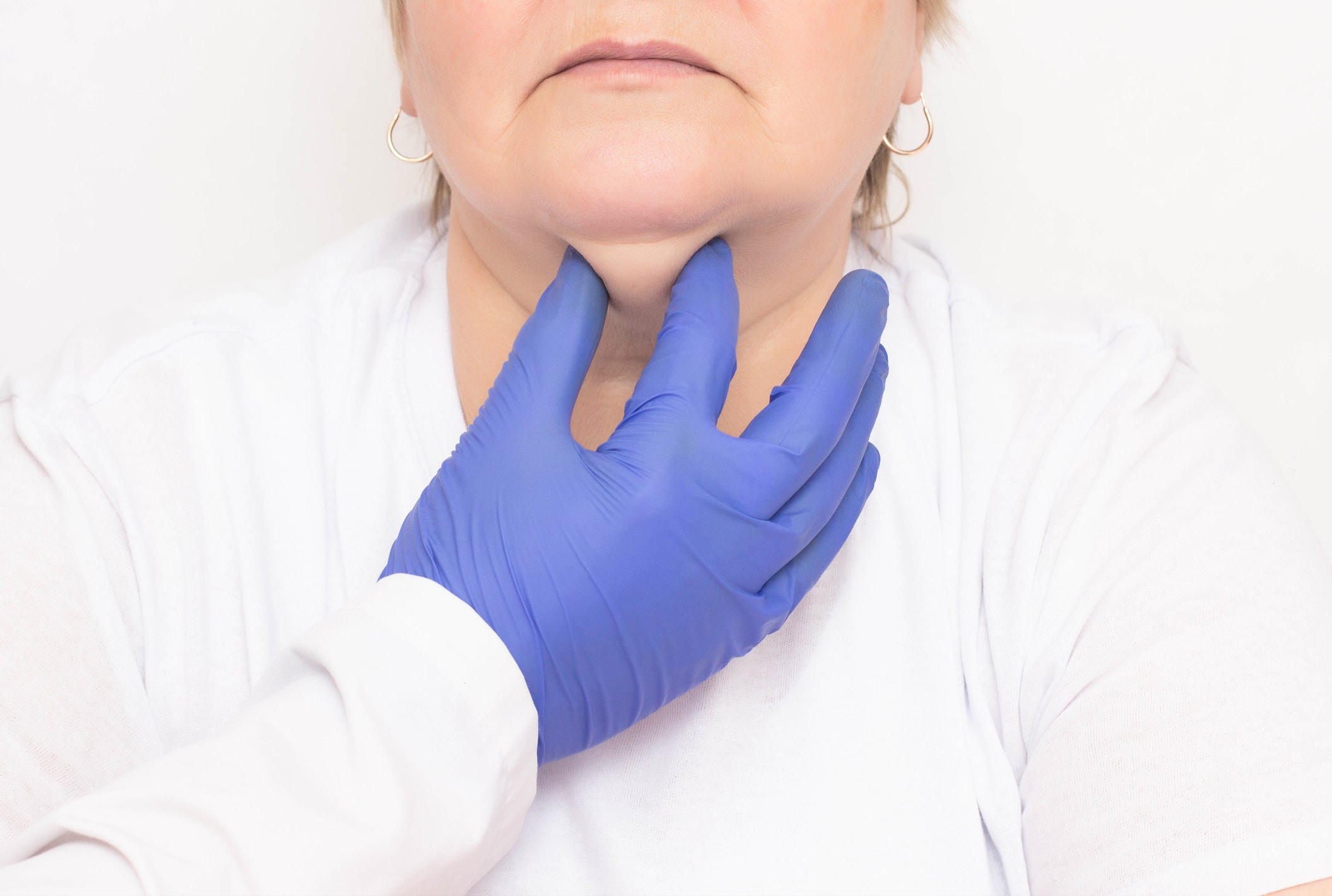 Gloved hand on medical professional assessing fat under woman's chin