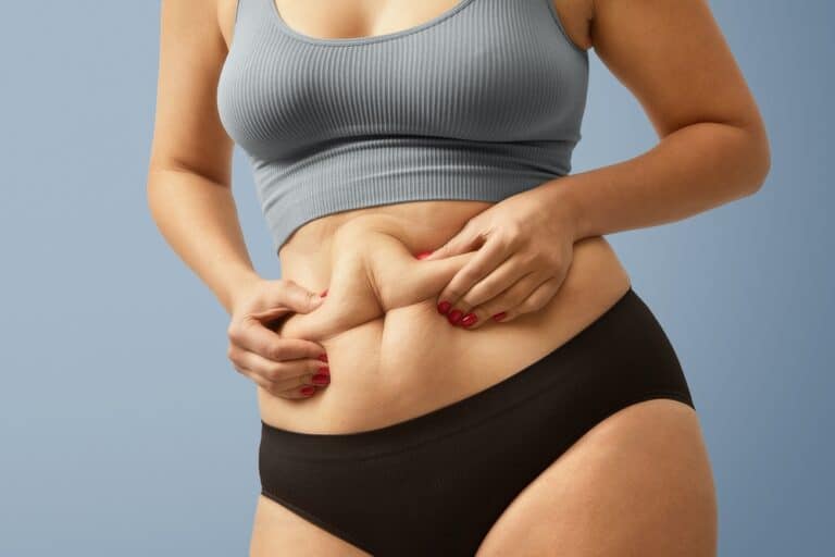 Woman pinching her midsection where she may be a candidate for high scar tummy tuck surgery.