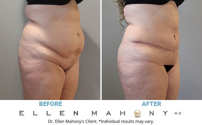 Before and After Image: Case #10817 - right-front-oblique