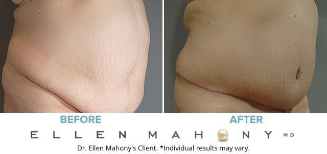 Before and After Image: Case #8347 - right-front-oblique