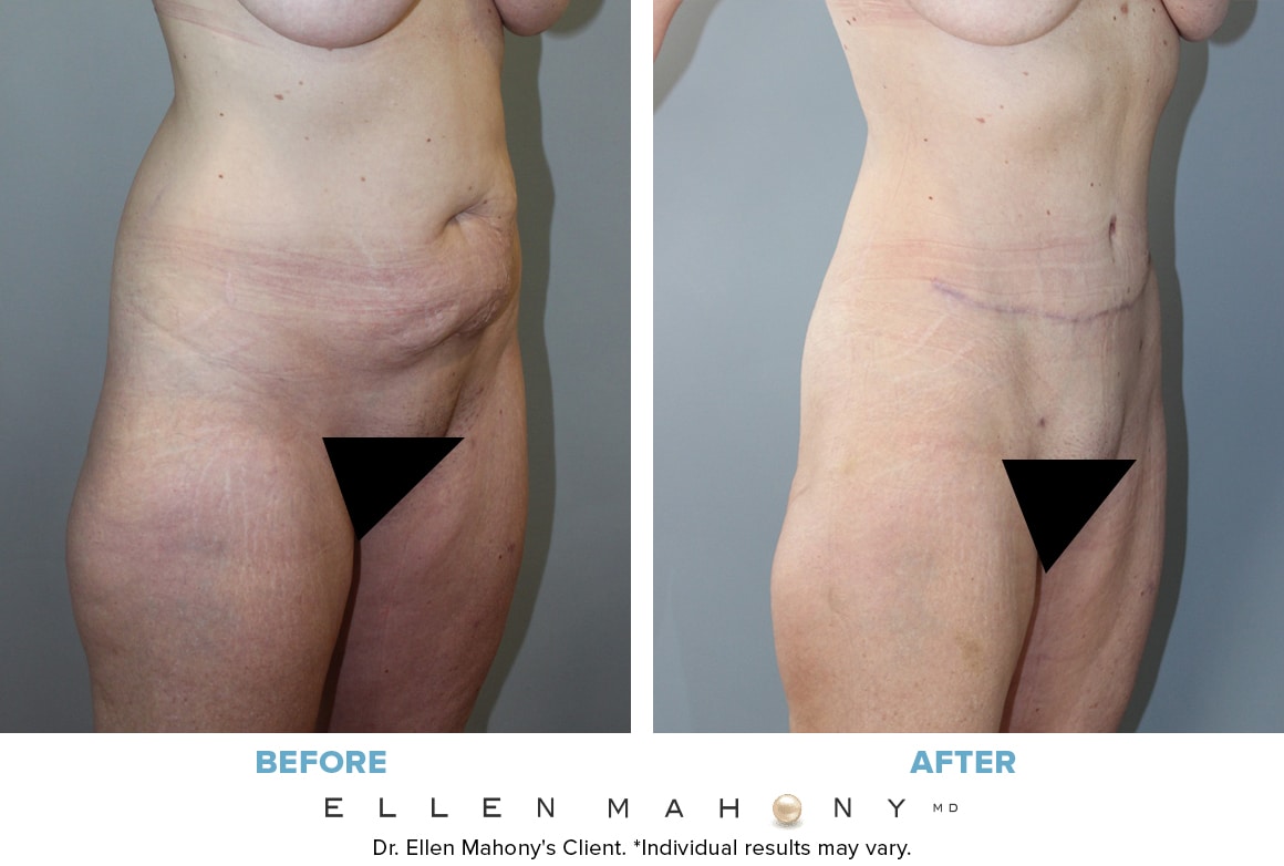 Before and After Image: Case #13695 - right-front-oblique