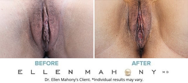 Before and After Image: Case #10598 - front