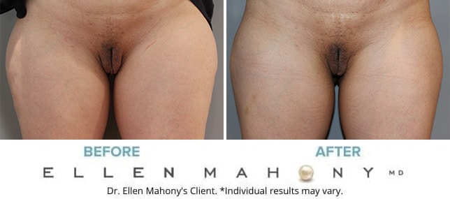 Before and After Image: Case #10598 - front