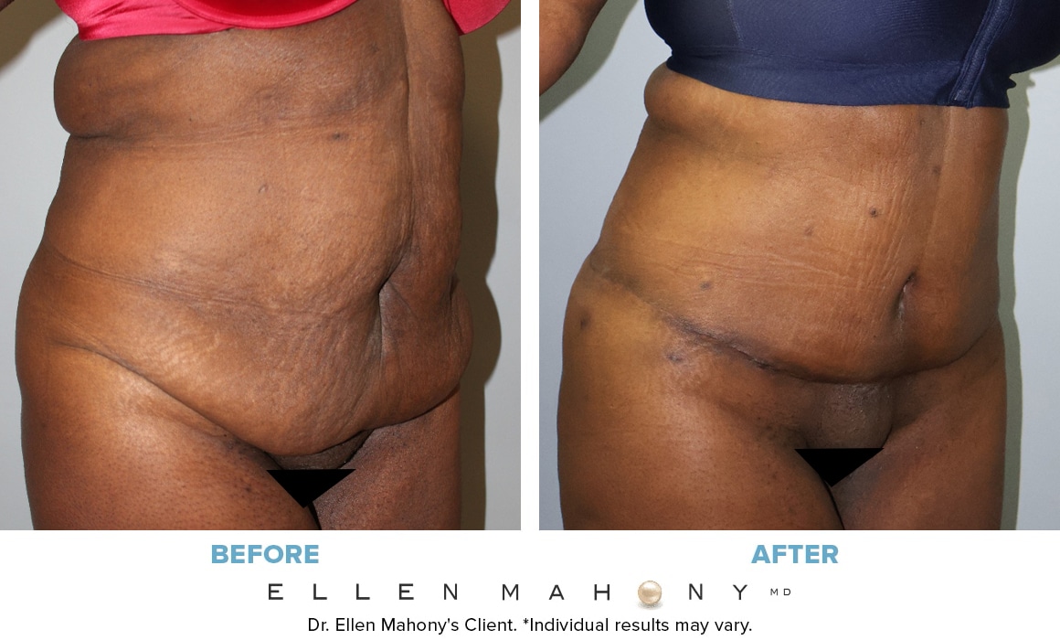 Before and After Image: Case #14589 - right-front-oblique