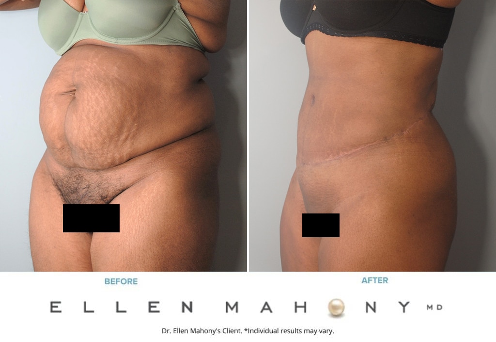 Before and After Image: Case #9968 - left-front-oblique