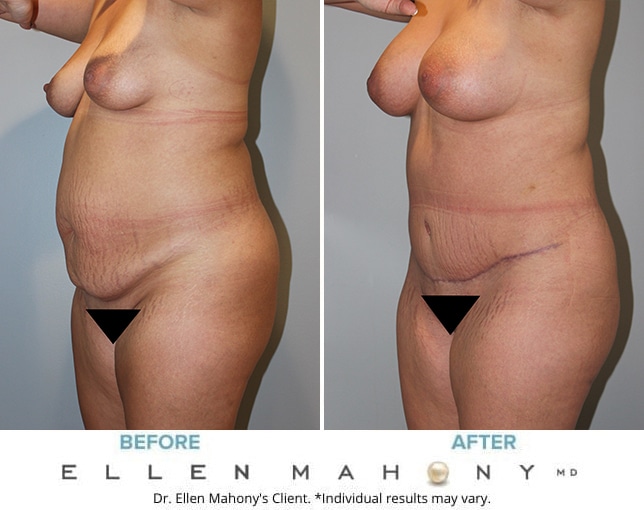 Before and After Image: Case #10119 - left-front-oblique