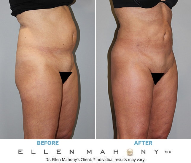 Before and After Image: Case #6327 - right-front-oblique