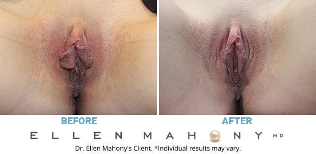 Before and After Image: Case #11988 - front