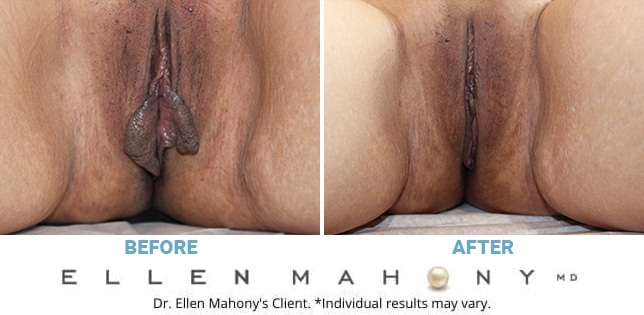 Before and After Image: Case #7810 - front