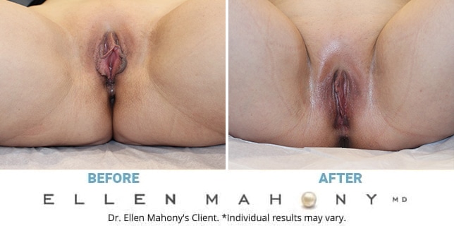 Before and After Image: Case #13307 - front