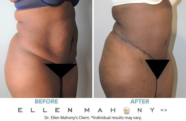 Before and After Image: Case #9749 - right-front-oblique