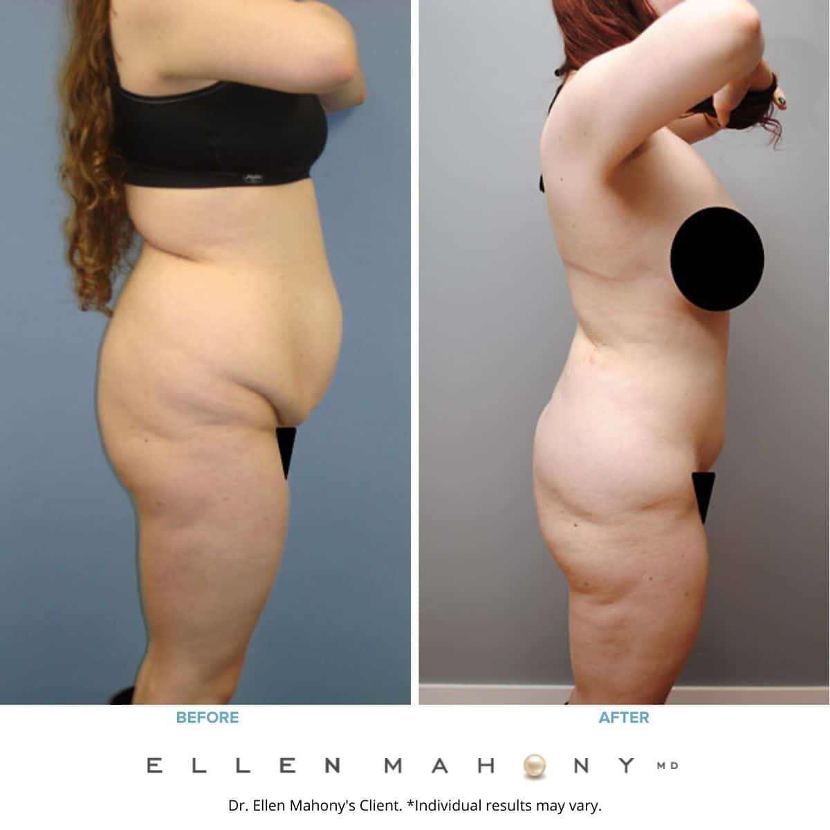 Before and After Image: Case #2088 - front