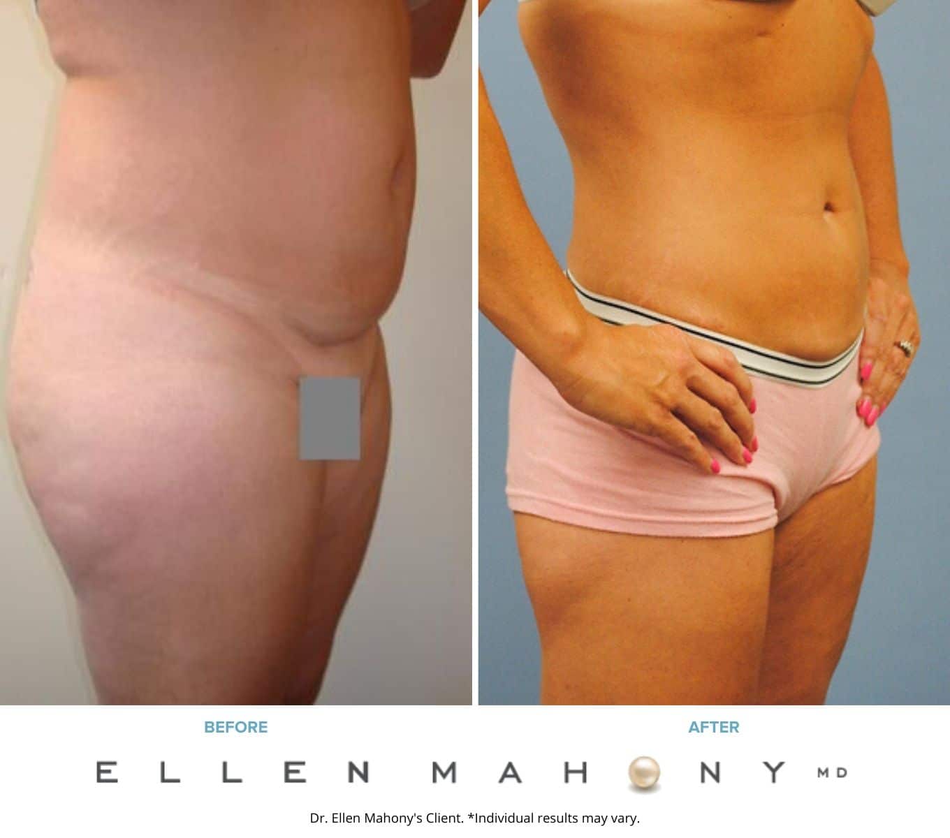 Before and After Image: Case #2239 - right-front-oblique