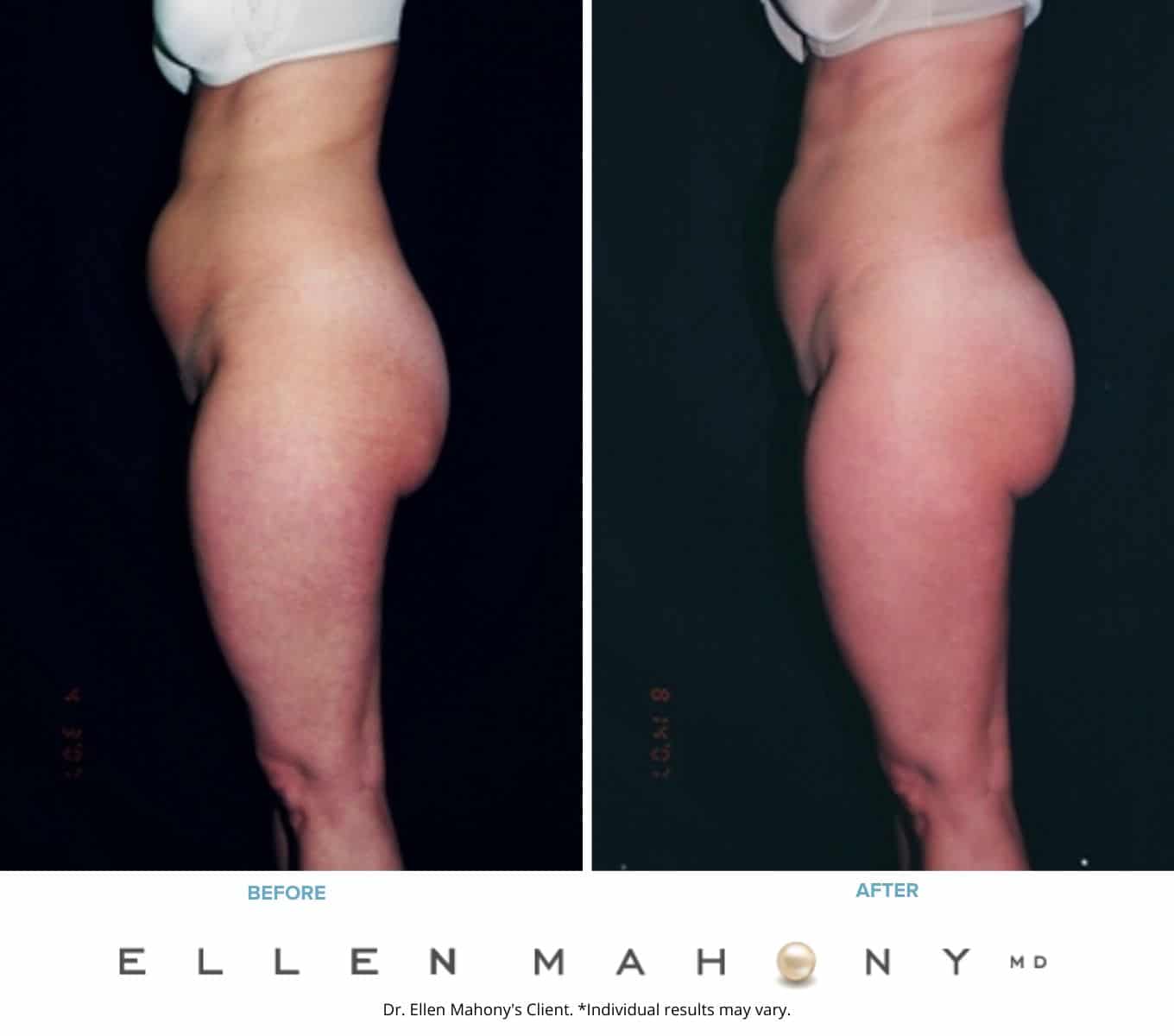 Before and After Image: Case #2267 - front