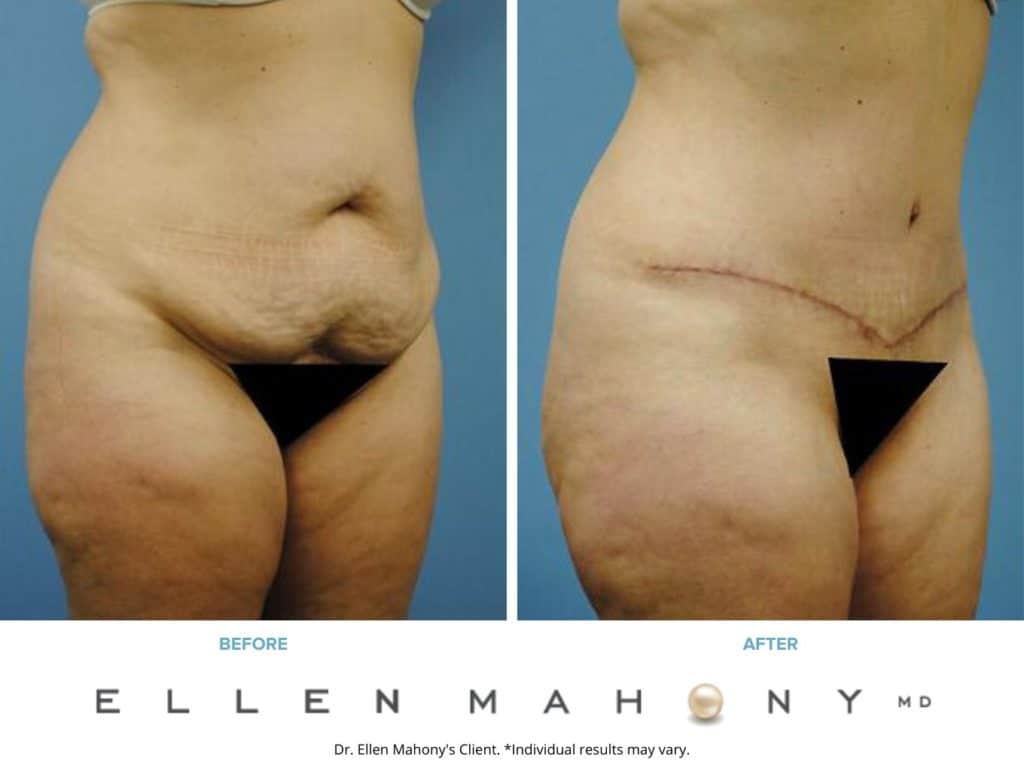 Before and After Image: Case #2293 - right-front-oblique