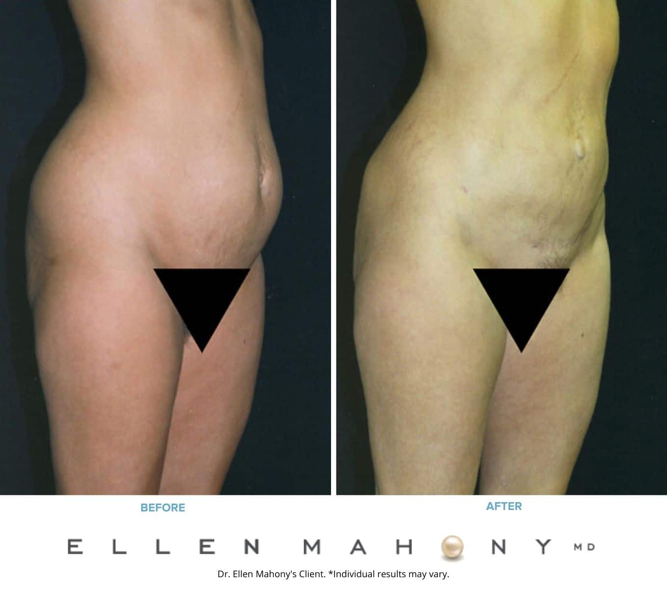 Before and After Image: Case #2351 - right-front-oblique