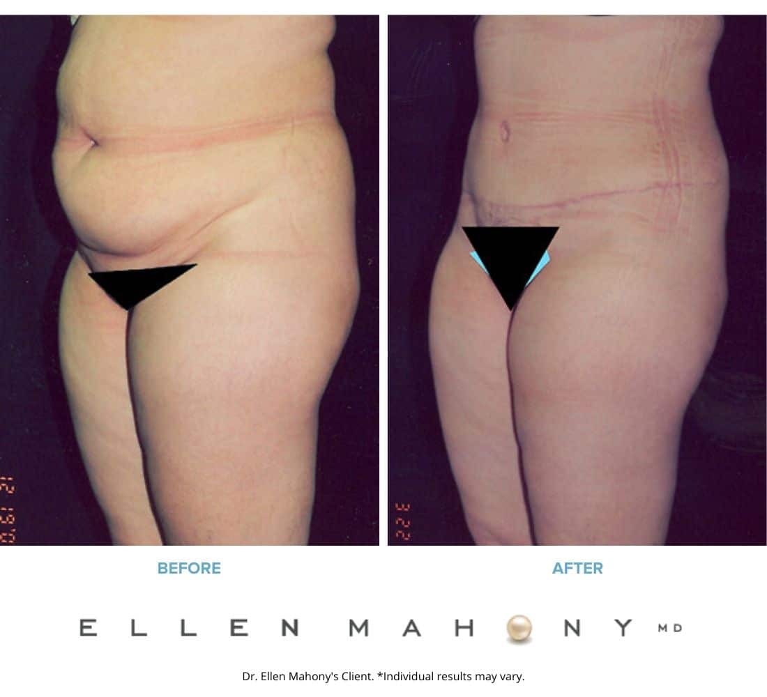 Before and After Image: Case #2438 - left-front-oblique