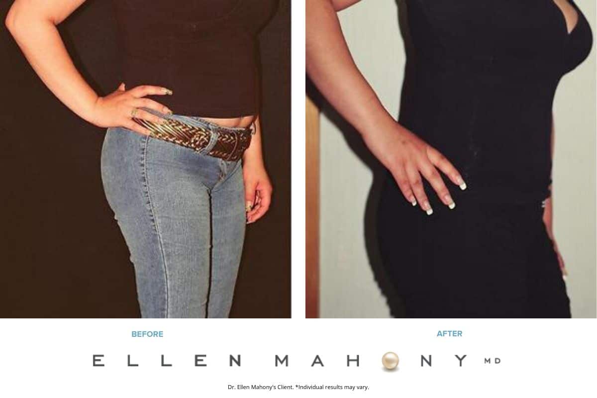 Before and After Image: Case #2462 - right-front-oblique
