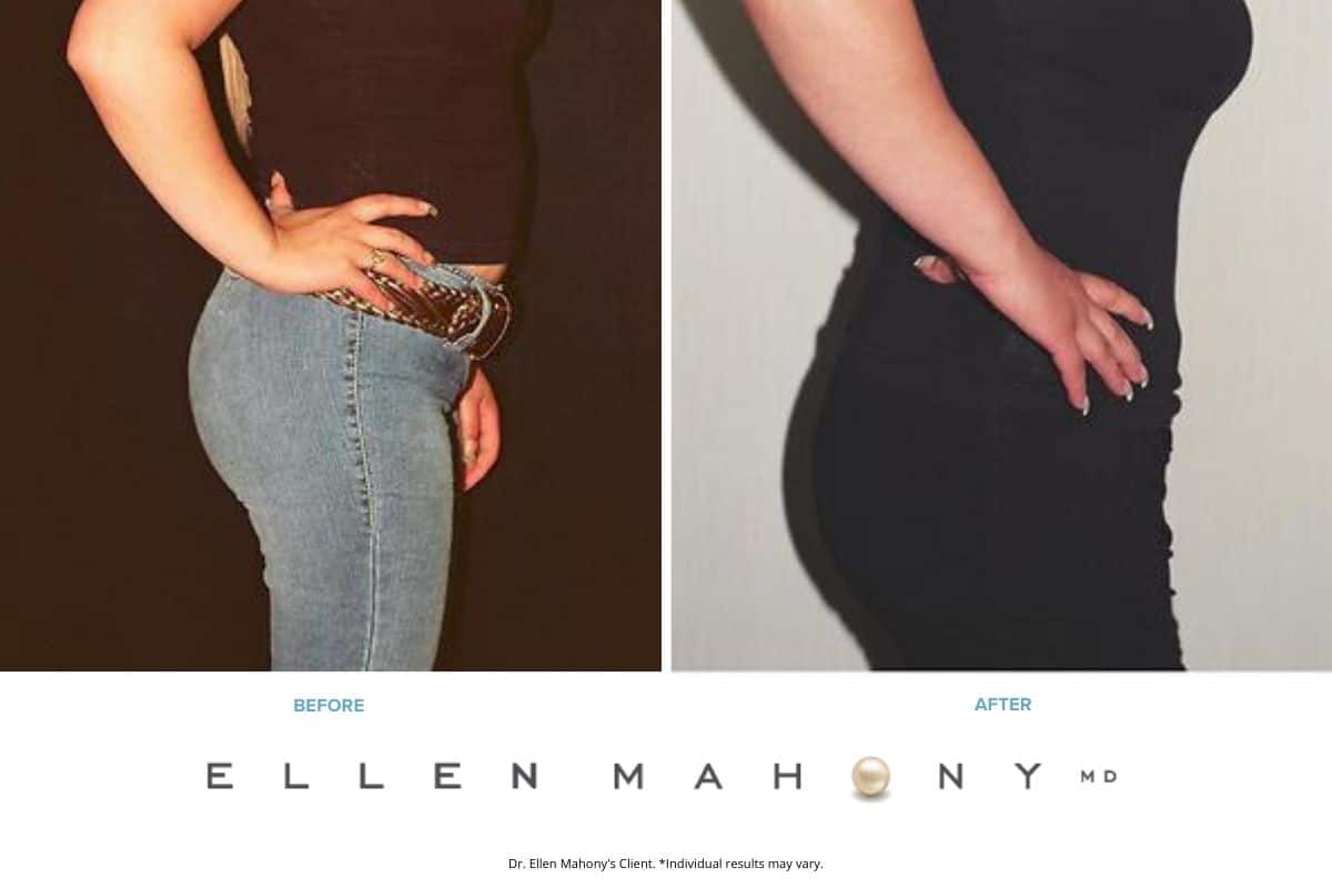 Before and After Image: Case #2462 - right-side
