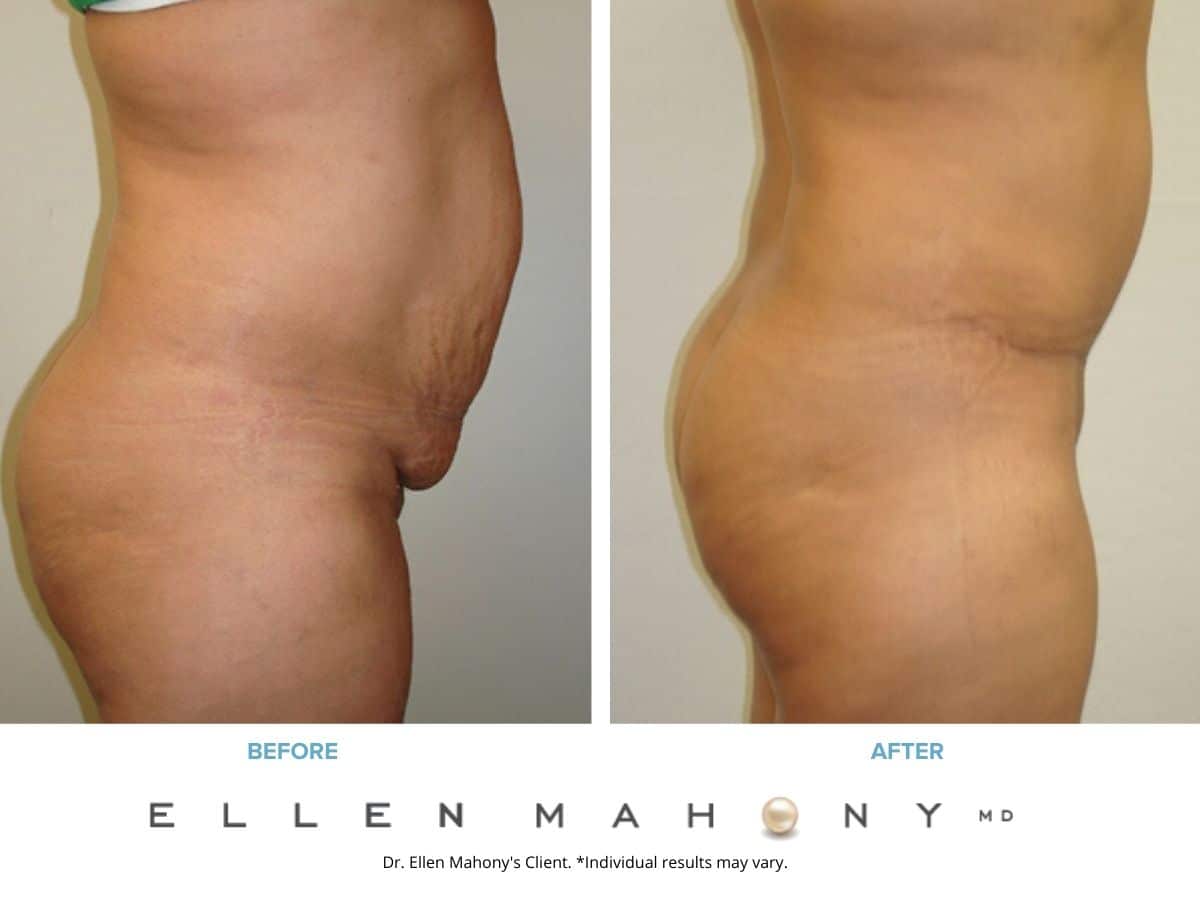 Before and After Image: Case #2469 - right-side