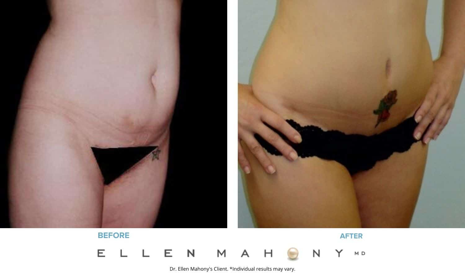 Before and After Image: Case #2474 - right-front-oblique