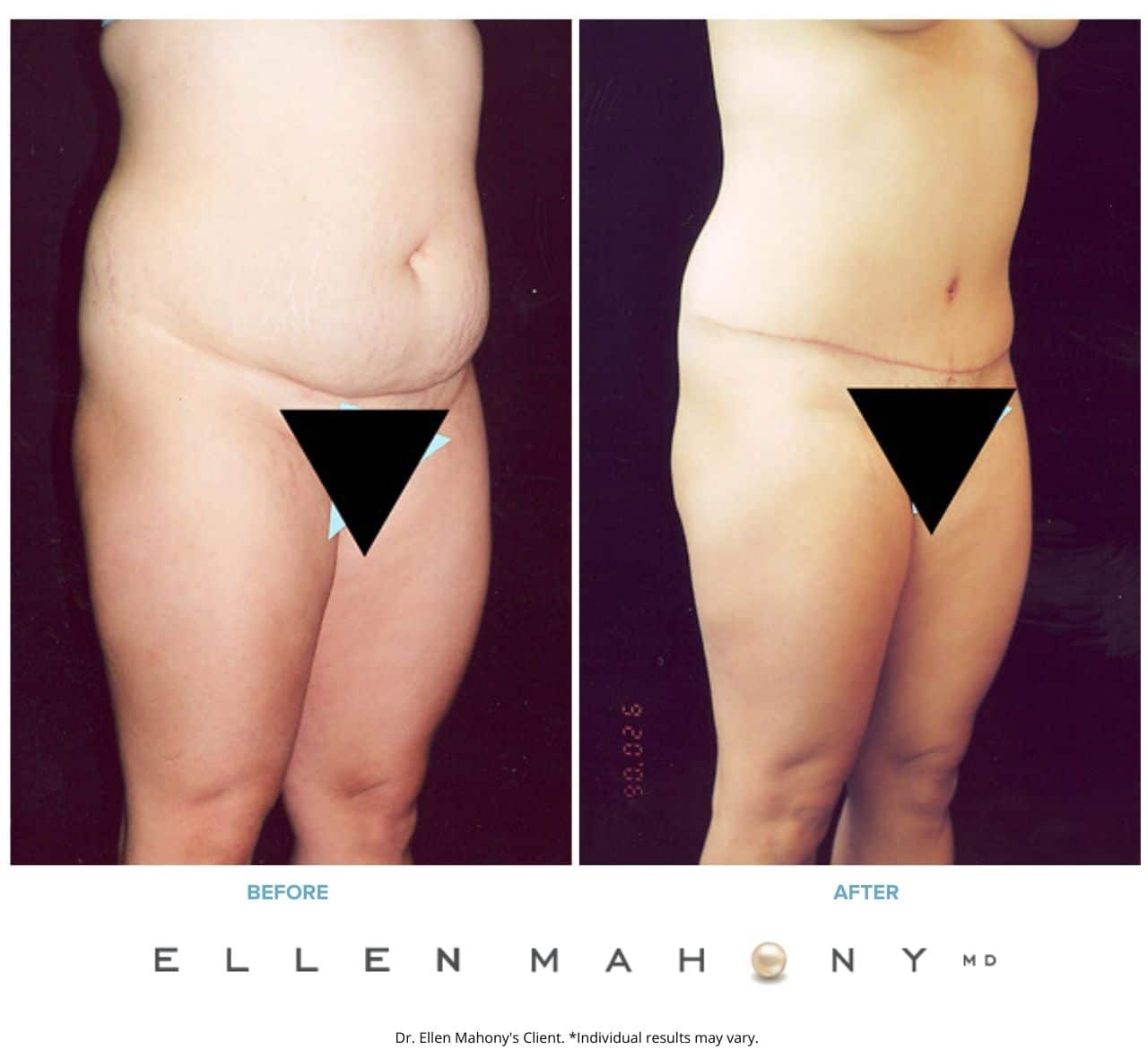 Before and After Image: Case #2519 - right-front-oblique
