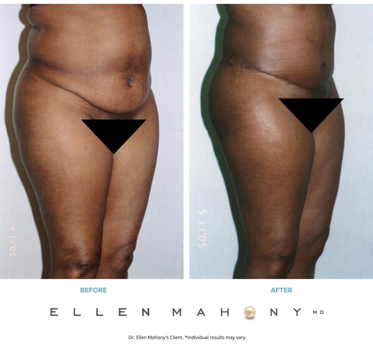 Before and After Image: Case #2524 - right-front-oblique