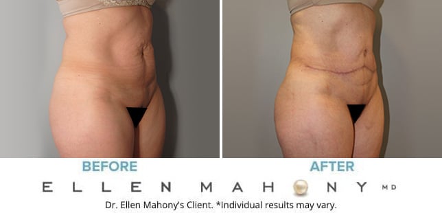 Before and After Image: Case #10251 - right-front-oblique