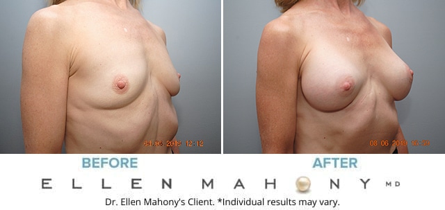 Before and After Image: Case #8078 - right-front-oblique