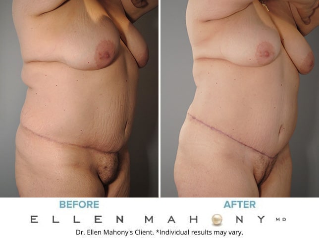 Before and After Image: Case #8347 - right-front-oblique