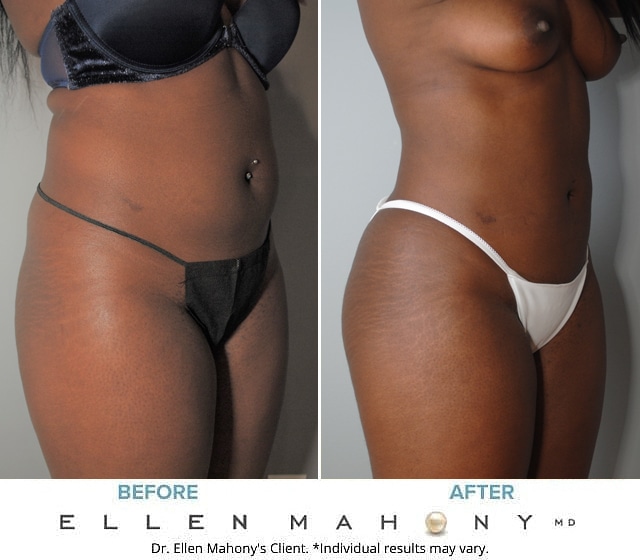 Before and After Image: Case #8894 - right-front-oblique