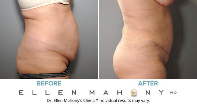 Before and After Image: Case #8976 - right-side