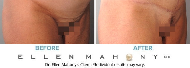 Before and After Image: Case #9182 - right-front-oblique