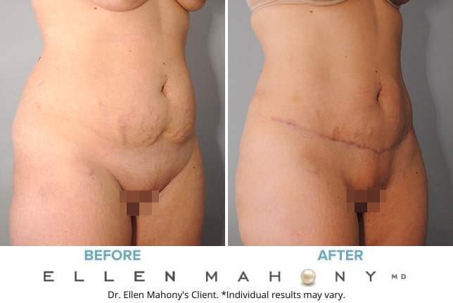 Before and After Image: Case #9278 - right-front-oblique