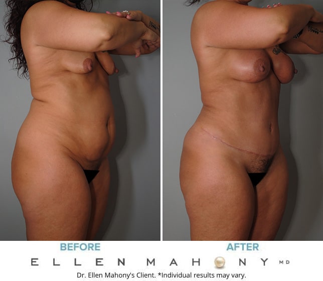 Before and After Image: Case #9673 - right-front-oblique