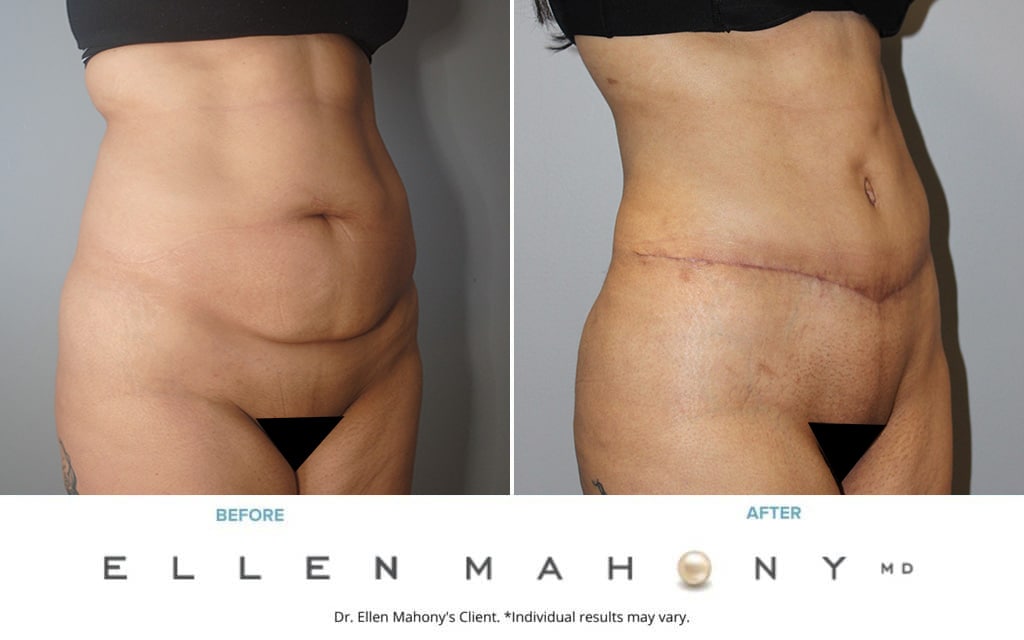 Before and After Image: Case #9959 - right-front-oblique