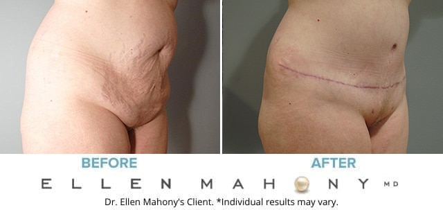 Before and After Image: Case #7395 - right-front-oblique