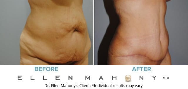 Before and After Image: Case #6310 - right-front-oblique