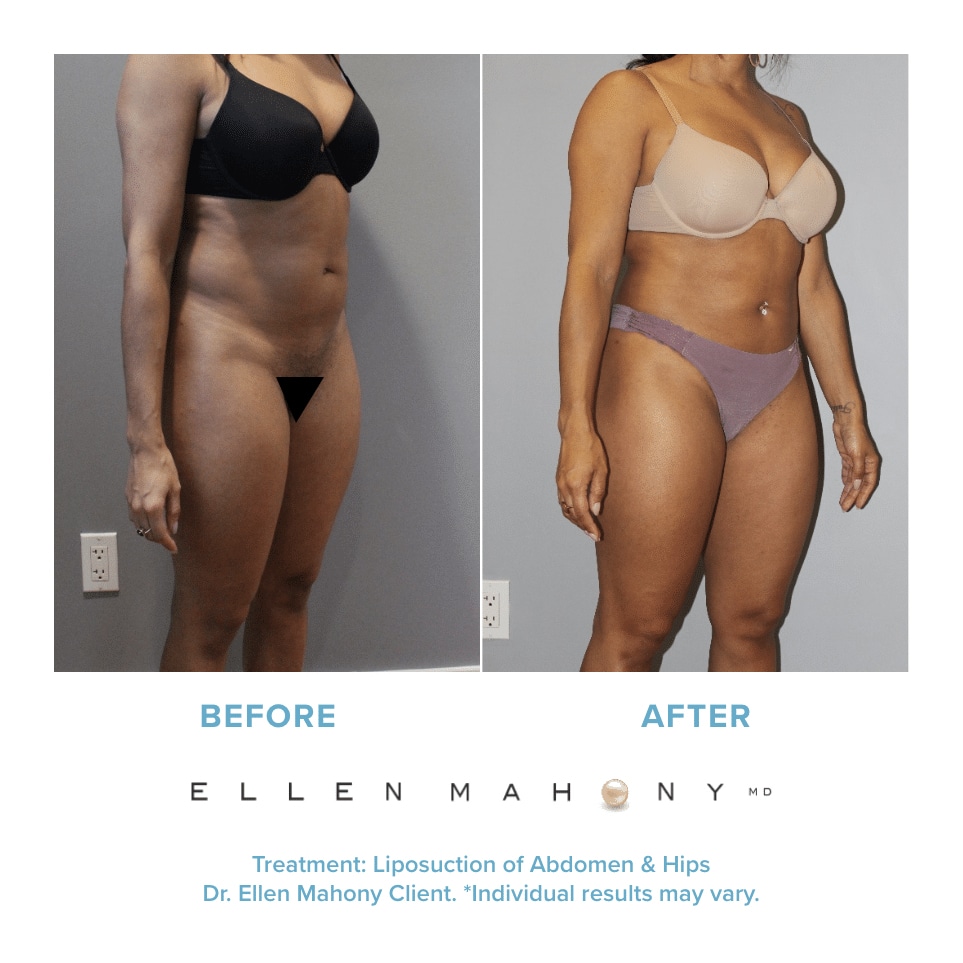Before and After Image: Case #12181 - right-front-oblique