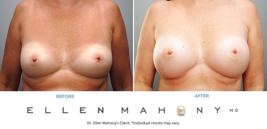 Before and After Image: Case #8997 - front
