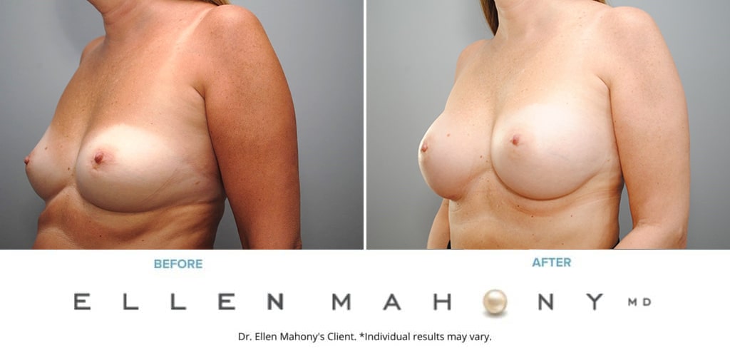 Before and After Image: Case #8997 - left-front-oblique
