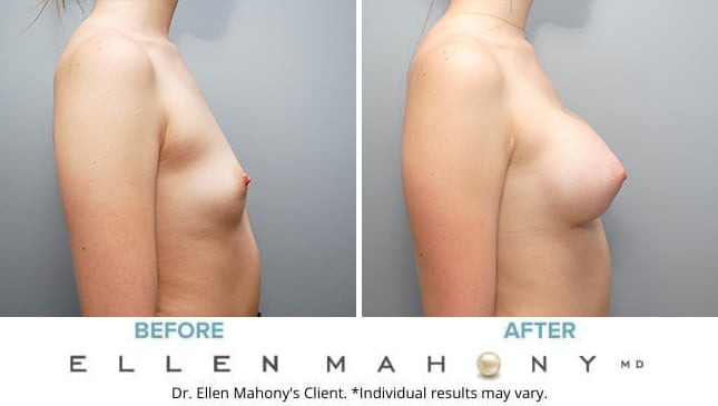 Before and After Image: Case #10005 - right-side