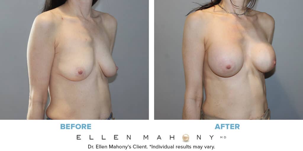 Before and After Image: Case #10097 - right-front-oblique