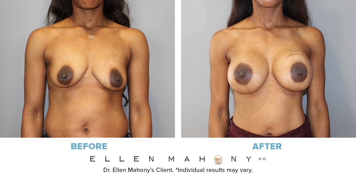 Before and After Image: Case #13696 - front